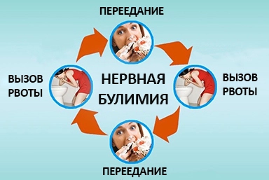 Лечение булимии в Супонево